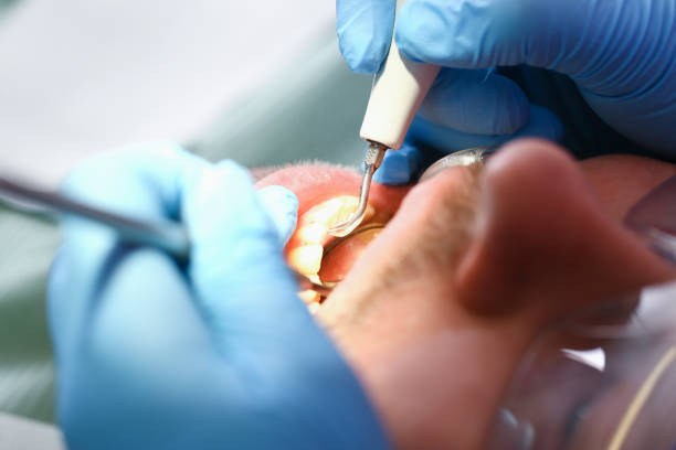 Best Emergency Treatment for Toothache in Shively, KY