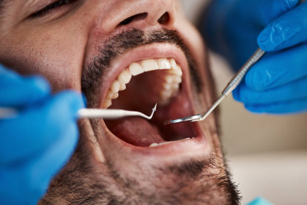 Best Emergency Tooth Extraction in Shively, KY